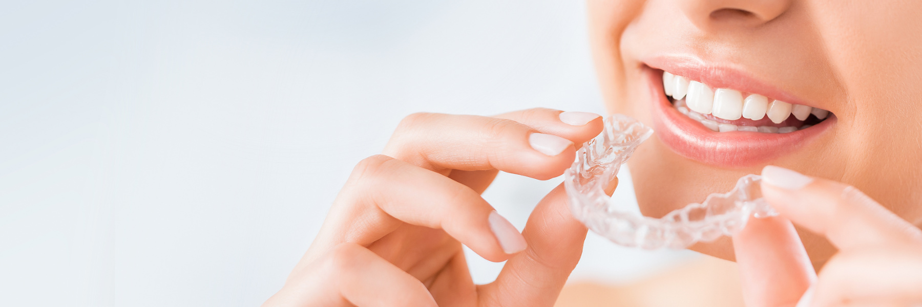 Clear Aligners | Dentist